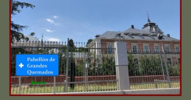 Sobre manos chamuscadas y otras quemaduras